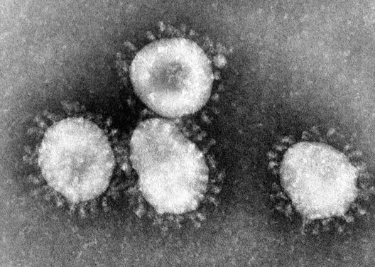 1200px_coronaviruses_004_lores.jpg 1200px_coronaviruses_004_lores.jpg
