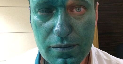 Пасля нападу невядомага Навальны можа аслепнуць на адно вока