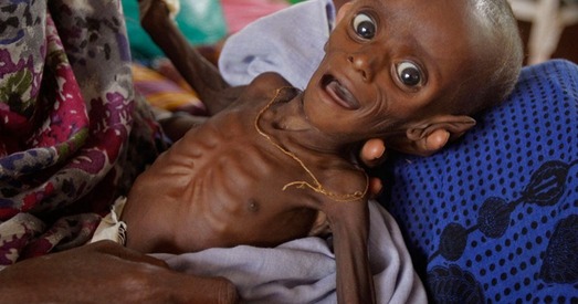 У Самалі ад голаду памерлі больш за сто чалавек за двое сутак