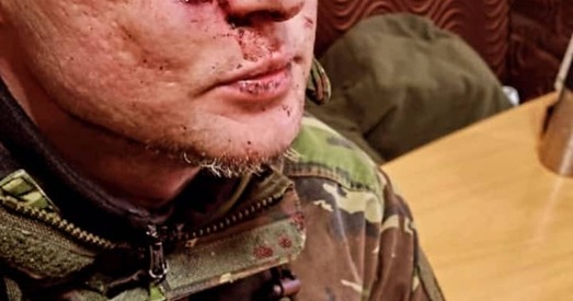 Паранены вакаліст гурта «Бумбокс» Андрэй Хлыўнюк