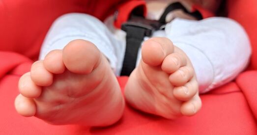 Атапічны дэрматыт: адкуль бярэцца і што з ім рабіць