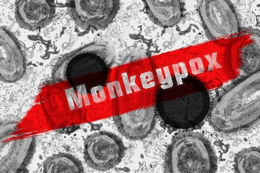 monkey_pox_g5a69d11b3_1280.jpg monkey_pox_g5a69d11b3_1280.jpg