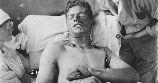 Як хімічная зброя зьмяніла правілы вайны