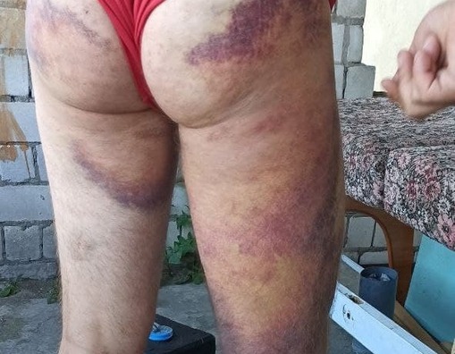 paslya_zbitstsya_kryhu_zazhyla2.jpg paslya_zbitstsya_kryhu_zazhyla2.jpg