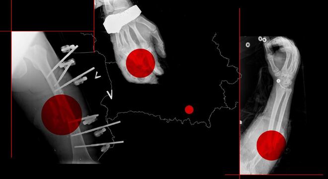 «Расійцы проста аддавалі нам сваіх параненых, ім было напляваць на іх» «Расійцы проста аддавалі нам сваіх параненых, ім было напляваць на іх»