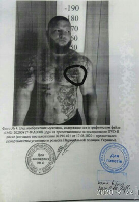 З матэрыялаў суда. Беларускія ўлады ставяць у віну Зайцаву татуіроўку з выявай сімвала анархіі. Фота: dumskaya.net З матэрыялаў суда. Беларускія ўлады ставяць у віну Зайцаву татуіроўку з выявай сімвала анархіі. Фота: dumskaya.net