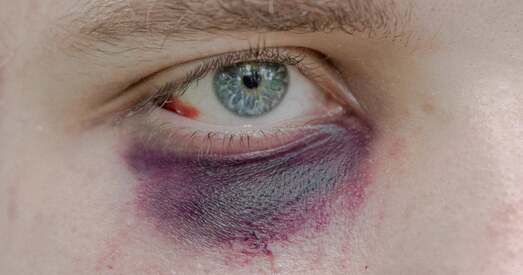 Польскі фатограф атрымаў міжнародную прэмію за праект «Шнары» — пра падаўленне пратэстаў у Беларусі