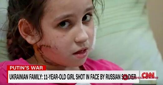 Расіец стрэліў у твар украінкай дзяўчынцы
