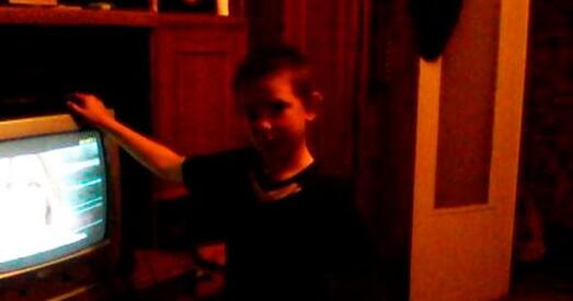 Шасцікласнік Стас 5 дзён скардзіўся на тугі гіпс, пакуль не ампутавалі руку