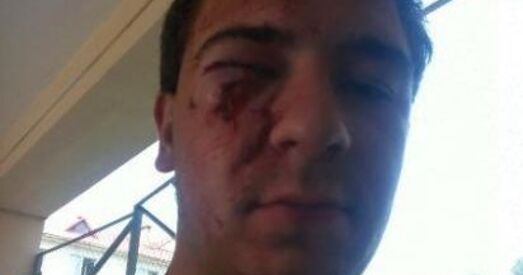 За майку з «Пагоняй» збілі актывіста «Еўрапейскай Беларусі»