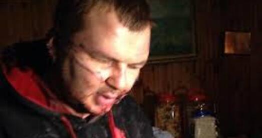 Дзякуй, што жывы: лідар Аўтамайдану знайшоўся, але моцна збіты, парэзаны