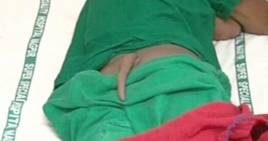 Індыйскаму юнаку выдалілі 20-сантыметровы хвост (фота)